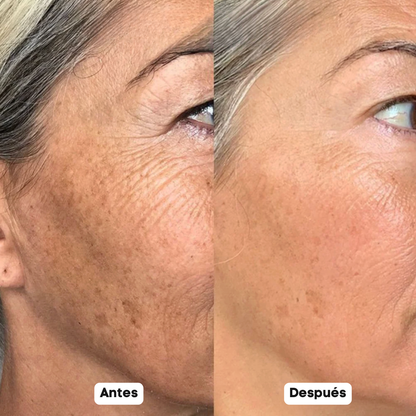 Sérum Coreano con PDRN